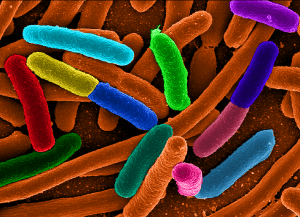 diverse_e_coli